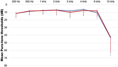 Audiological and psychological assessment of tinnitus patients with normal hearing